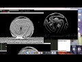 Sobel Edge Detector | Code-Implementation-Python | Feature point