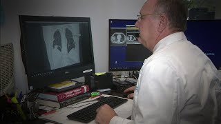 Advancements in diagnosis and treatment of lung cancer improving patient outcomes
