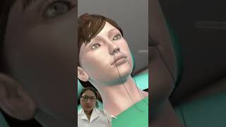 Illustration of sinus surgery #p1 #doctor #3danimationsurgery #animation #animation