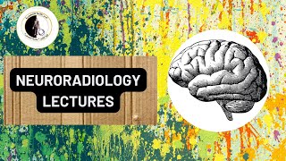 White matter Disorders - Dr. Gehad Saleh