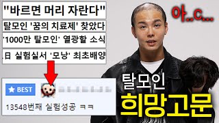 1000만 탈모인들 화나게 하는 기사들 (n번째 성공 ㄷㄷ)