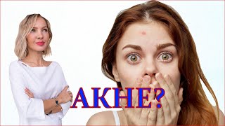 Какие у тебя прыщи? | Какая степень Акне? | узнай как избавиться!