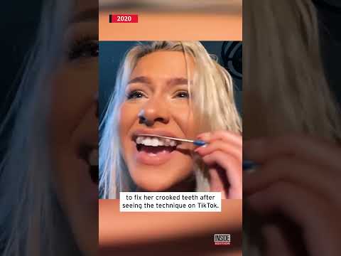 Is it bad to nail file your teeth?