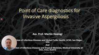 Point of Care and Innovative Diagnosis of Invasive Aspergillosis: The Future is now