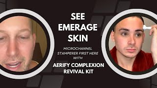 SEE EMERAGESKIN MICROCHANNEL STAMPERER FIRST HERE WITH AERIFY COMPLEXION REVIVAL KIT |Dr. Jason Emer