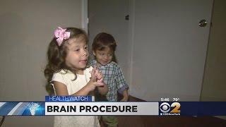 Dr. Max Gomez: Brain Glue For Babies