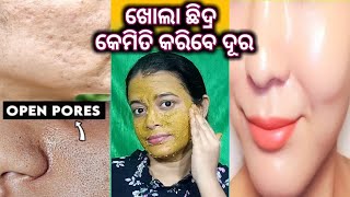 Open pores treatment naturally at home in #odia || no more open pores || Arpita bidyapriya