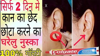 ear hole closing without surgery! कान का छेद छोटा कैसे करें!  #Earhole