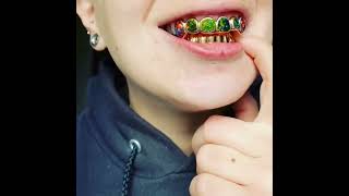 Teeth jewellery...!