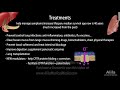 cystic fibrosis pathophysiology genetics symptoms diagnosis and treatments animation