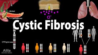 Cystic Fibrosis: Pathophysiology, Genetics, Symptoms, Diagnosis and Treatments, Animation
