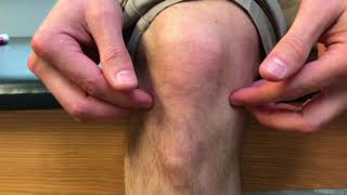 Knee Pain Types Explained | Royersford, PA | Limerick, PA