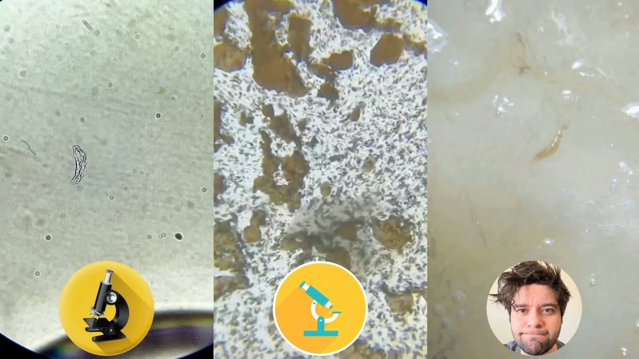 Hot Dog Under Microscope Tiktok At Stephen Bobo Blog