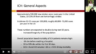 Neuro Lecture: Intracranial Hemorrhage with Dr Santosh Murthy