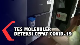 Tes Cepat Molekuler Deteksi Covid-19