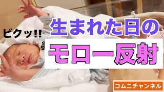 【生後0日！】モロー反射/Moro Reflex (the date of birth)【原始反射】