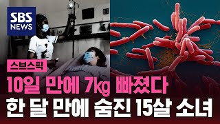 10일 만에 7㎏ 빠져…한 달 만에 숨진 15살 소녀 / SBS / 스브스픽