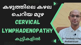 Cervical Lymphadenopathy | കുട്ടികളിലെ കഴല വീക്കം #DrSandeepkraj #Pediatrician #Malayalam