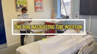 OSCE Fine Bore NGT Insertion