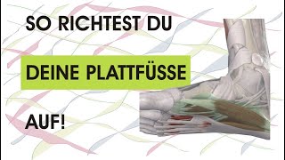 So richtest du deinen Plattfuß wieder auf! Funktioniert