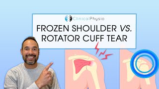 What is the Difference Between Frozen Shoulder And Rotator Cuff Tear? | Expert Physio Guide