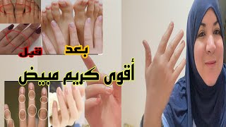 أقوى كريم تبييض لليدين ورجلين سواد العنق والمرفقين هاد سر معارفوش شي واحد 👌💯💯