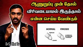 ஆணுறுப்பு முன் தோல் விரிவடையாமல் இருந்தால் என்ன செய்ய வேண்டும்  | DrSJ Men's Wellness #fimosis