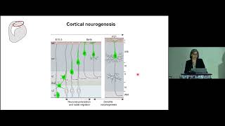 NeuroPSI-Chen Institute Joint Conference 2023 | Sandrine Humbert