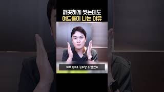 깨끗히 씻어도 여드름이 계속 생기는 이유!