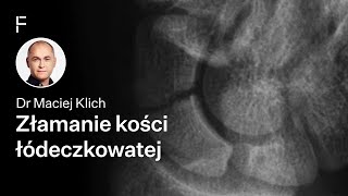 Złamanie kości łódeczkowatej - przyczyny, diagnostyka i leczenie