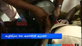 Thiruvananthapuram News- Toddler's head trapped in a cooking pot