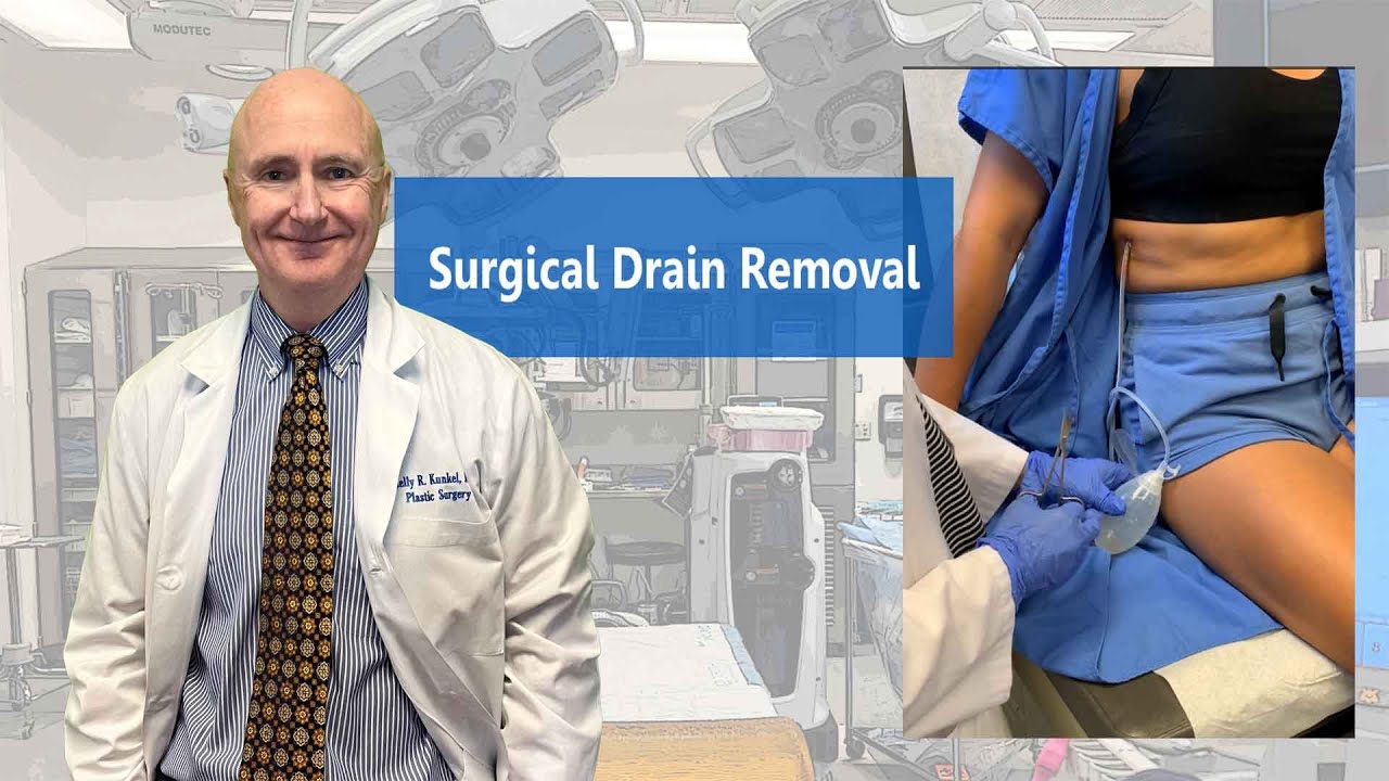 Surgical Drain Removal Procedure At Susie Branch Blog