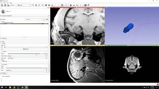 10. 3D Slicer - How to use the "Models" module