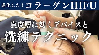 進化したコラーゲンHIFU！真皮層にしっかり効くポイントを解説！