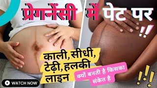 Nabhi Line se kaise pata kare Ladka hai ya Ladki | Baby Boy Prediction in Pregnancy
