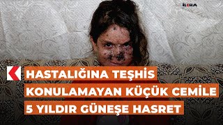 Hastalığına teşhis konulamayan küçük Cemile 5 yıldır güneşe hasret