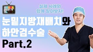 [모티브 성형외과] 눈밑지방재배치와 하안검수술 part.2 ! 20대와 60대 전후 사진과 함께 비교분석 알아보자!