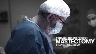 Mastectomy (Removal of a Breast with cancer) - Prof. Dr. Zoran Spirovski - One Hospital 2022