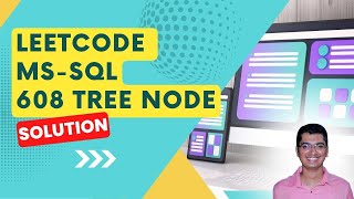 LeetCode MSSQL 608: Tree Node