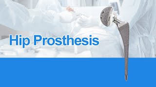 CZMEDITECH-Hip Prosthesis titanium hip prosthesis Medical Implants Product Display