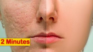 High End Skin Retouching in Photoshop|Add Skin texture| Hindi / Urdu |Perfect skills
