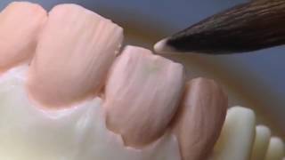 Matrix Dentincutback HeraCeram ceramics