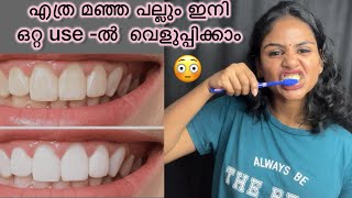 എത്ര മഞ്ഞ പല്ലും മാറ്റി വെളുപ്പിക്കാം| #youtubevideo #teethwhitening #entertainment