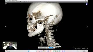 CBCT Toolkit Realtime demonstration