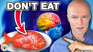 Top 10 Foods That DESTROY Your BRAIN