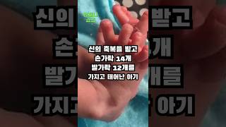 신의 축복을 받고 손가락 14개, 발가락 12개를 가지고 태어난 아기