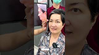 ดึงหน้าครบ 1 เดือน เป็นยังไงไปดูกันเลย #somekoclinic #someko #โซเมโกะ #หมอพีพีsomeko #ดึงหน้า