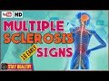 16 Multiple Sclerosis Symptoms Early Warning Signs