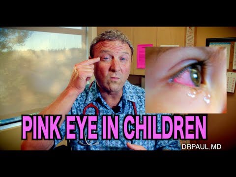 Pink Eye In Children | Pediatric Advice Pink Eye In Children | Pediatric Advice