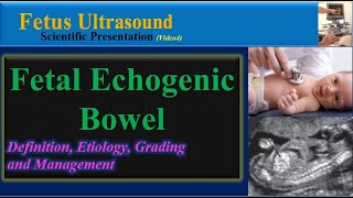 Fetus Ultrasound , Fetal Echogenic Bowel